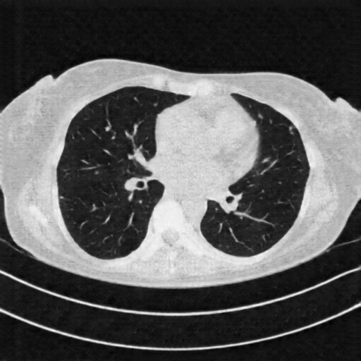 Generated VENOUS CT scan (A→B translation)