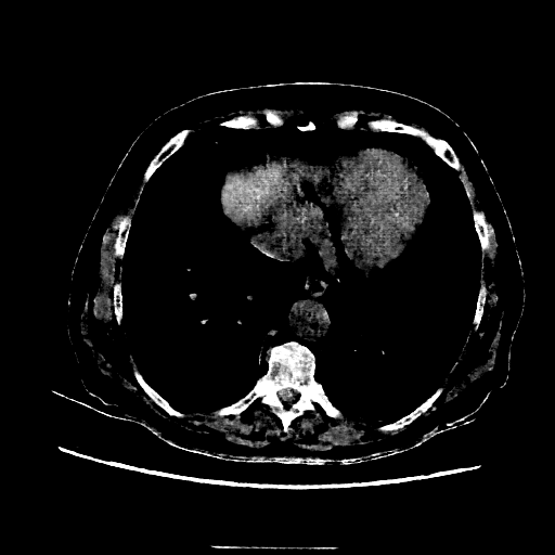 Generated VENOUS CT scan (A→B translation)