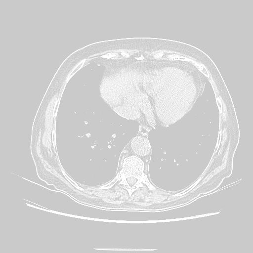 Original NATIVE CT scan (input)