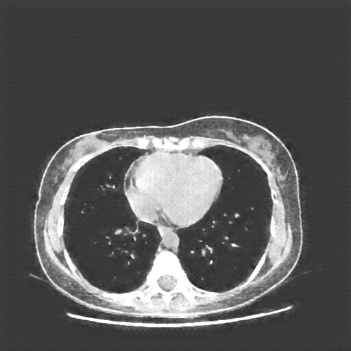 Generated VENOUS CT scan (A→B translation)
