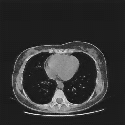 Generated VENOUS CT scan (A→B translation)