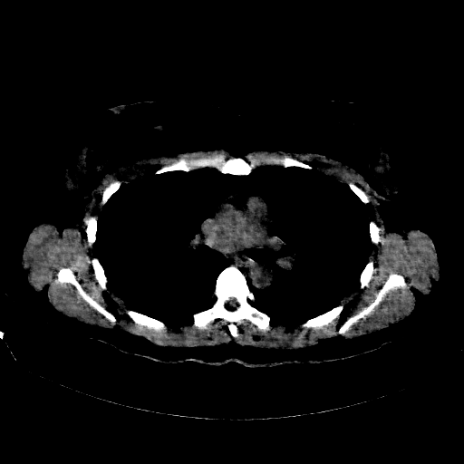 Generated VENOUS CT scan (A→B translation)
