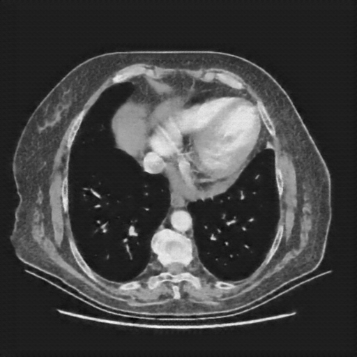Generated VENOUS CT scan (A→B translation)