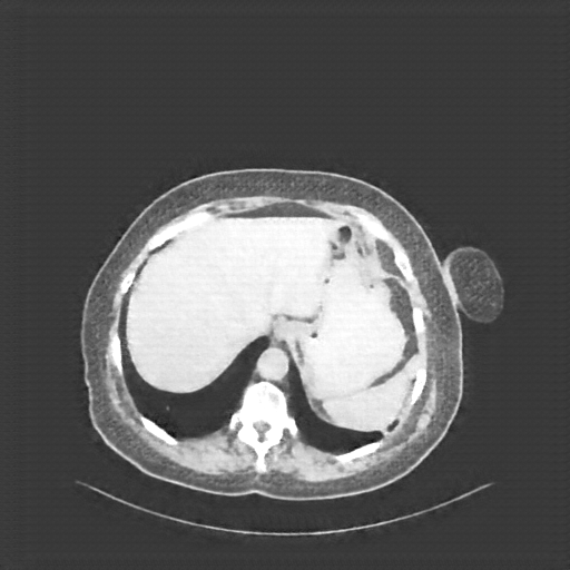 Generated VENOUS CT scan (A→B translation)