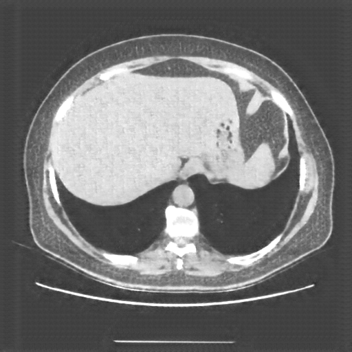 Generated VENOUS CT scan (A→B translation)