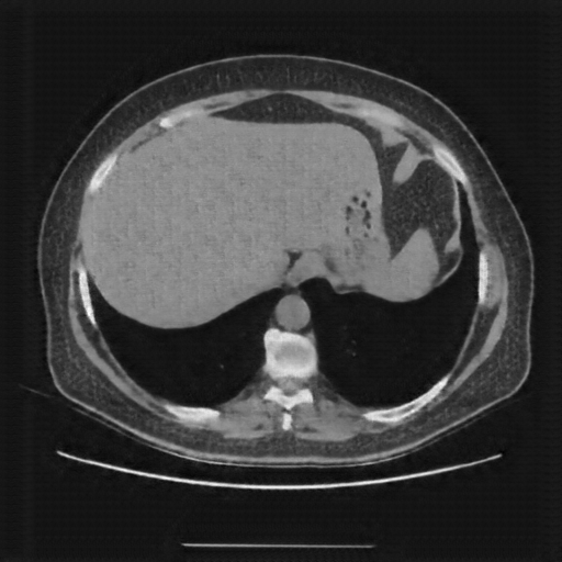 Generated VENOUS CT scan (A→B translation)