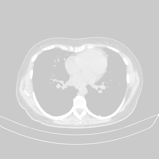 Original NATIVE CT scan (input)