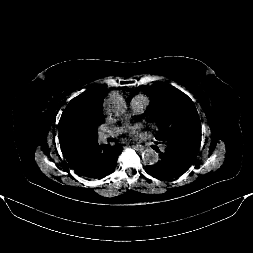 Generated VENOUS CT scan (A→B translation)