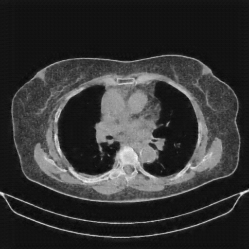 Generated VENOUS CT scan (A→B translation)