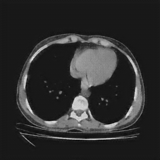Generated VENOUS CT scan (A→B translation)
