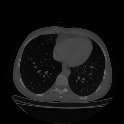 Original VENOUS CT scan