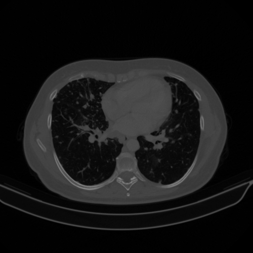 Original VENOUS CT scan