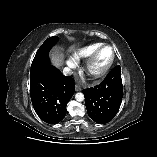 Generated VENOUS CT scan (A→B translation)