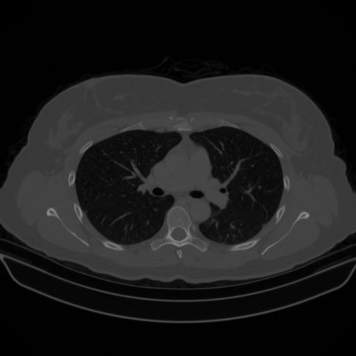 Original VENOUS CT scan