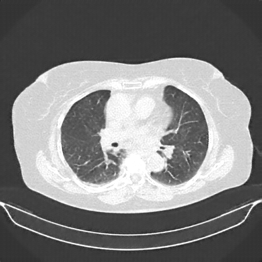 Generated VENOUS CT scan (A→B translation)
