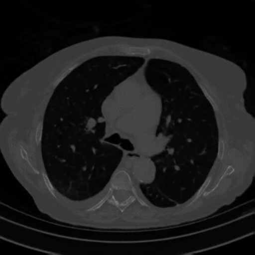 Generated VENOUS CT scan (A→B translation)
