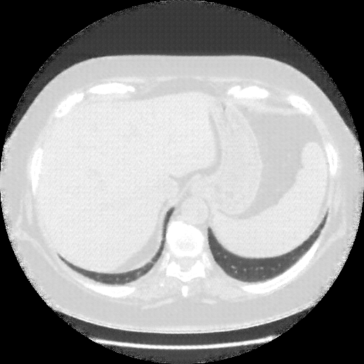 Generated VENOUS CT scan (A→B translation)
