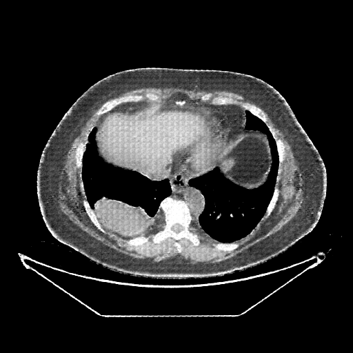 Generated VENOUS CT scan (A→B translation)