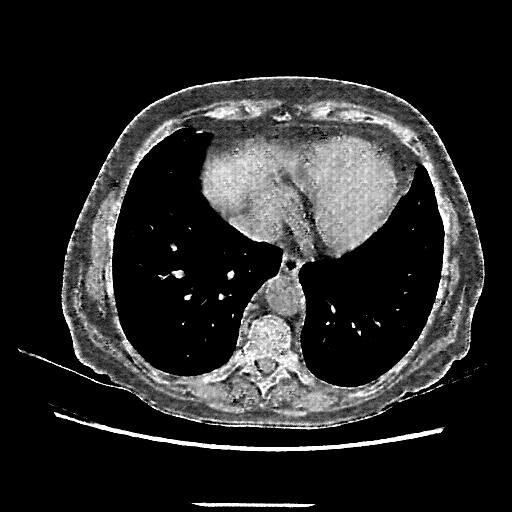 Generated VENOUS CT scan (A→B translation)