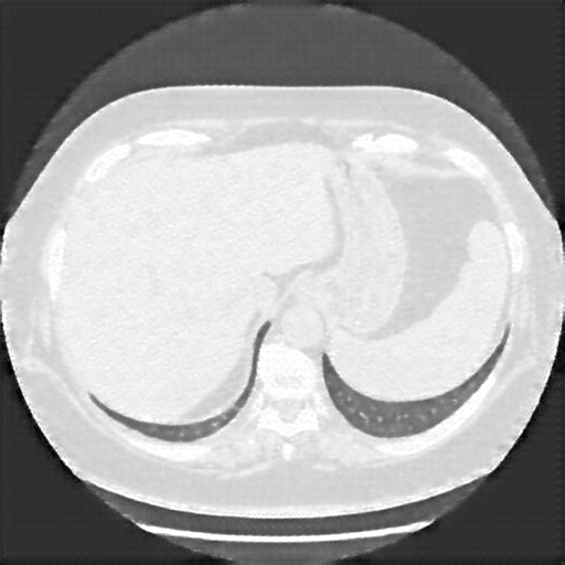 Reconstructed NATIVE CT scan (cycle consistency)