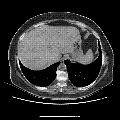 Generated VENOUS CT scan (A→B translation)