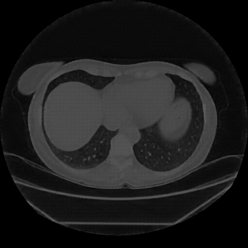 Generated VENOUS CT scan (A→B translation)