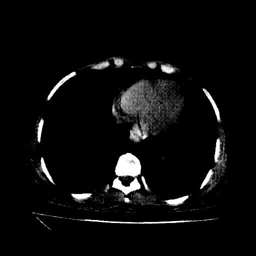 Generated VENOUS CT scan (A→B translation)