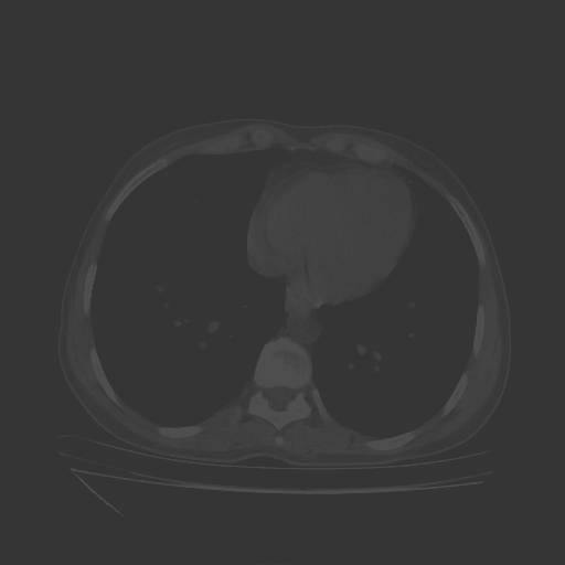 Original NATIVE CT scan (input)