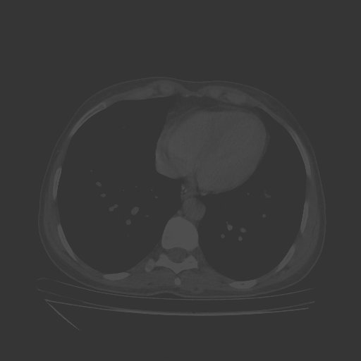 Original VENOUS CT scan