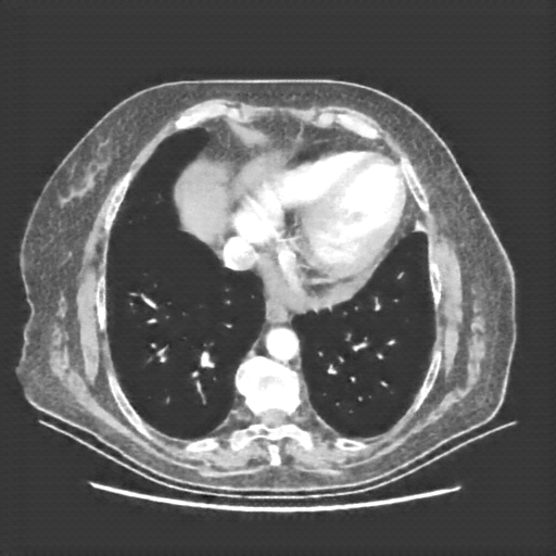 Generated VENOUS CT scan (A→B translation)