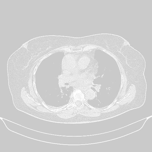 Original NATIVE CT scan (input)