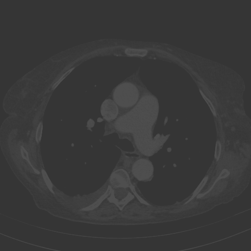 Original VENOUS CT scan