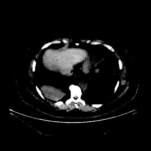 Generated VENOUS CT scan (A→B translation)