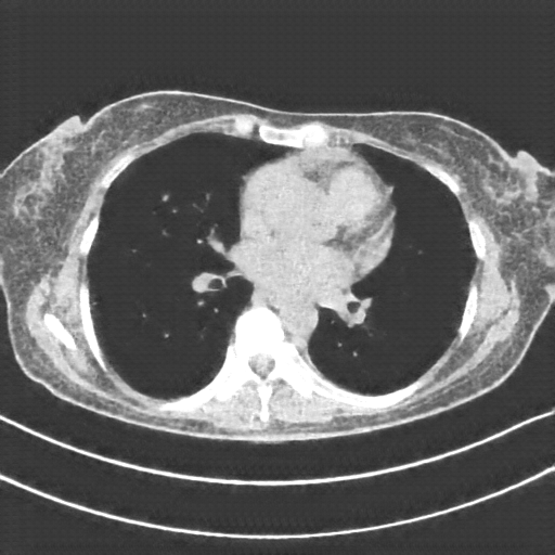 Generated VENOUS CT scan (A→B translation)