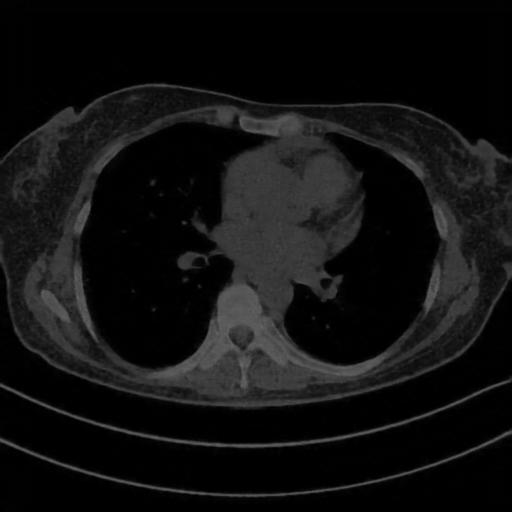 Generated VENOUS CT scan (A→B translation)