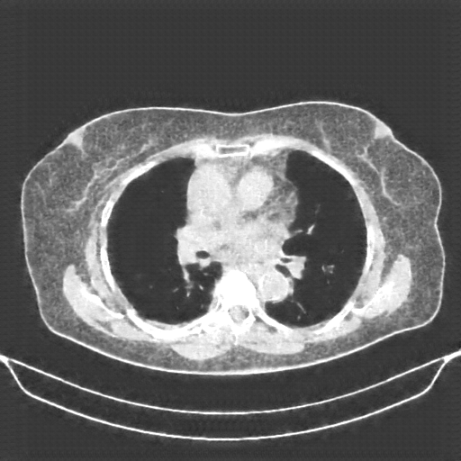 Generated VENOUS CT scan (A→B translation)