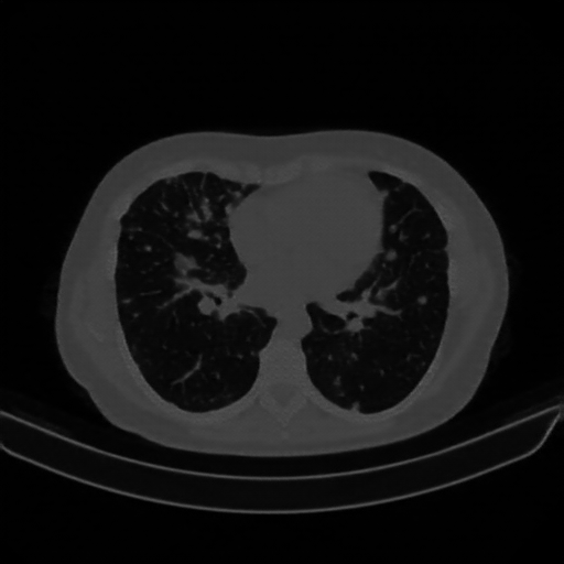 Reconstructed NATIVE CT scan (cycle consistency)