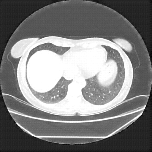 Generated VENOUS CT scan (A→B translation)