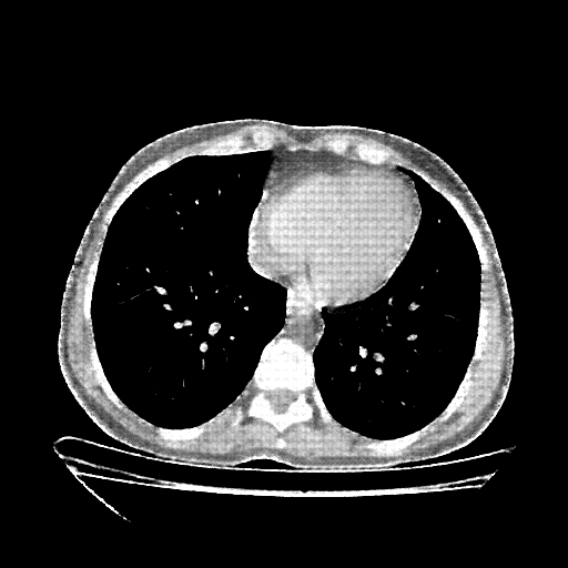 Generated VENOUS CT scan (A→B translation)