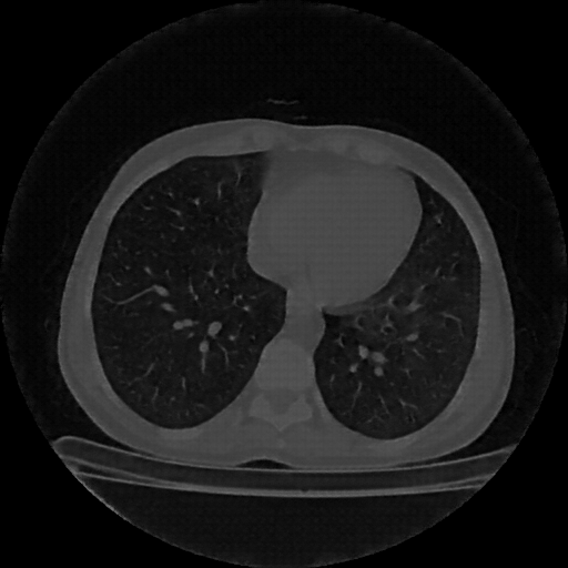 Generated VENOUS CT scan (A→B translation)