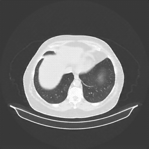 Reconstructed NATIVE CT scan (cycle consistency)