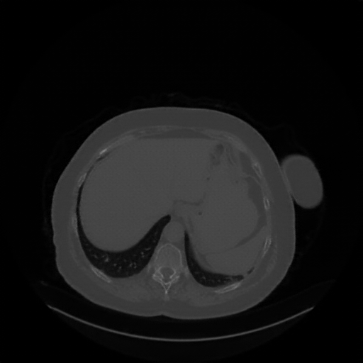 Generated VENOUS CT scan (A→B translation)