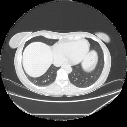 Generated VENOUS CT scan (A→B translation)