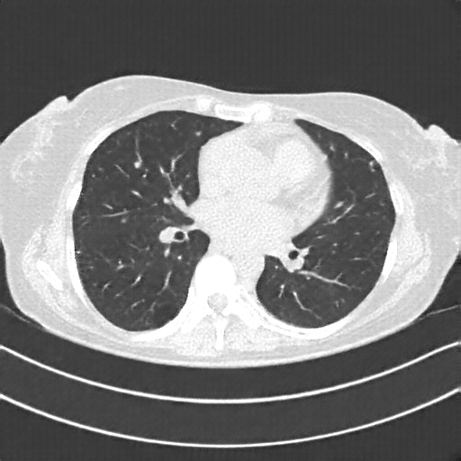 Generated VENOUS CT scan (A→B translation)
