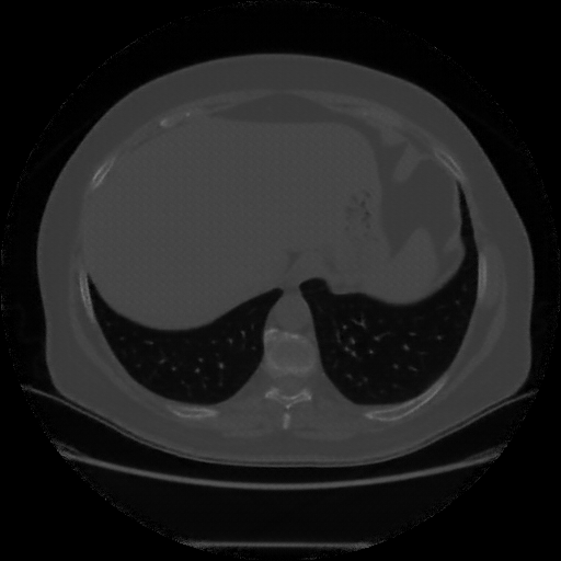 Generated VENOUS CT scan (A→B translation)