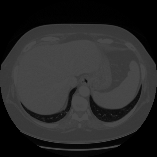 Original VENOUS CT scan