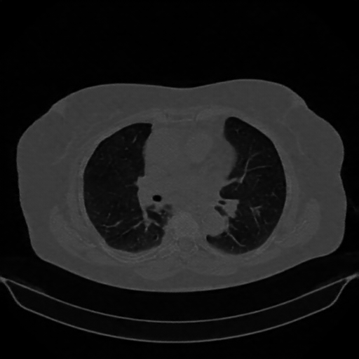 Reconstructed NATIVE CT scan (cycle consistency)