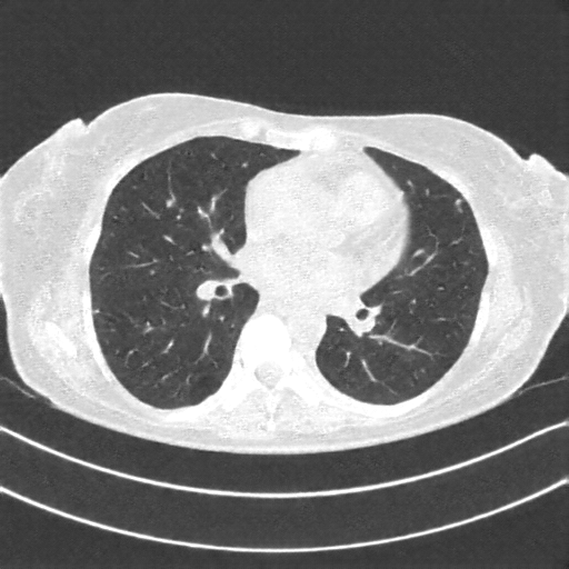 Generated VENOUS CT scan (A→B translation)