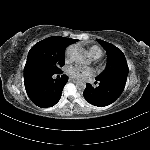 Generated VENOUS CT scan (A→B translation)