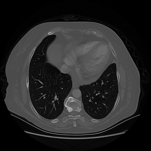Original NATIVE CT scan (input)